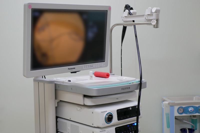 内視鏡検査・治療とは？