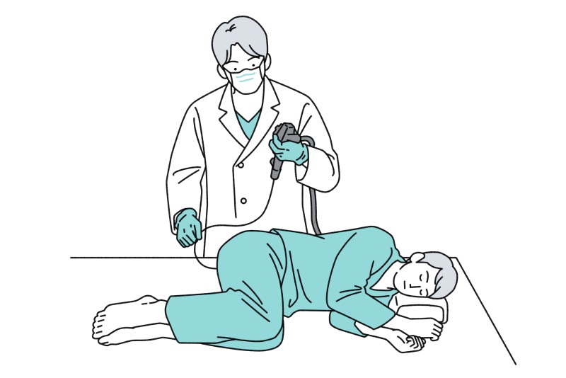 下部消化管内視鏡検査（大腸カメラ検査）