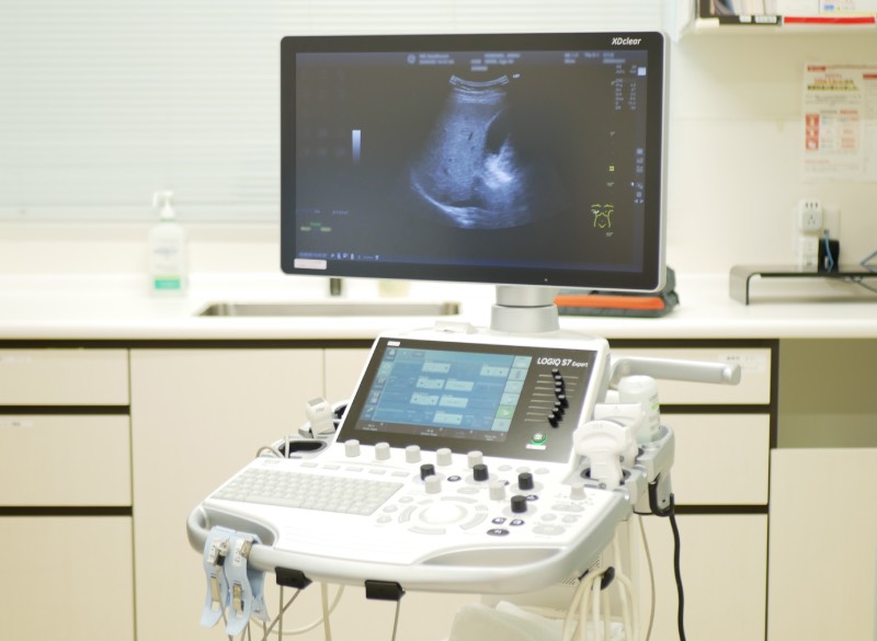 超音波画像診断装置